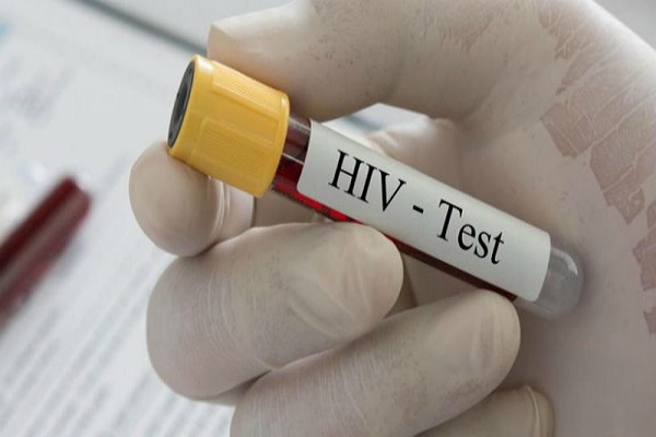 ХИВ тестирање Прилеп